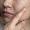 臉部過敏紅腫發癢？可能原因與改善對策一次看