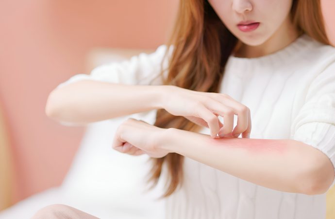 異位性皮炎（濕疹）治療全攻略：從日常護理到最新藥物