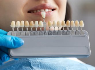 牙齒變黃原因是什麼?專業牙科醫生教你預防牙齒變黃