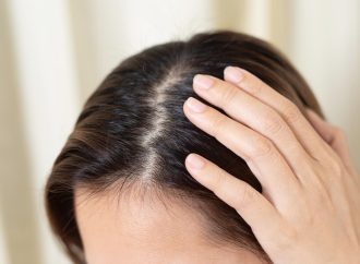 點樣分辨女性型脫髮？成因與求醫提示