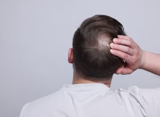 男士掉髮如何改善？3步找出合適的脫髮解決方法