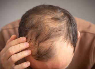 更年期脫髮問題怎樣改善?拆解成因、掉髮特徵與脫髮解決方法